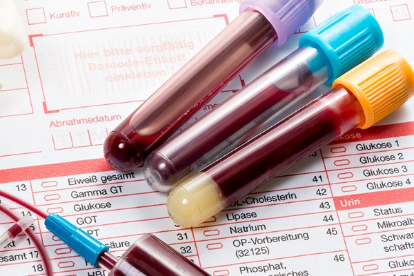 Расшифровка анализа крови на гормоны щитовидки